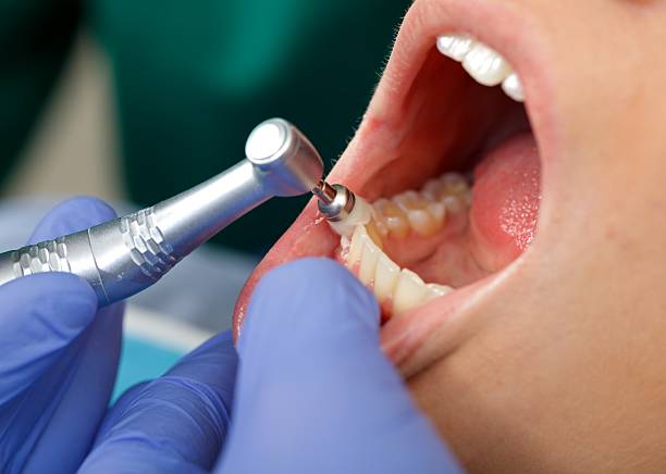 Best Wisdom Tooth Removal  in Mayville, ND